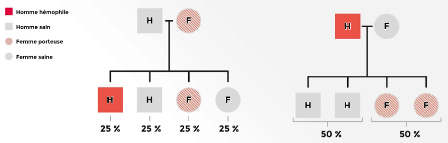 Arbre généalogique pour la transmission de l'hémophilie B