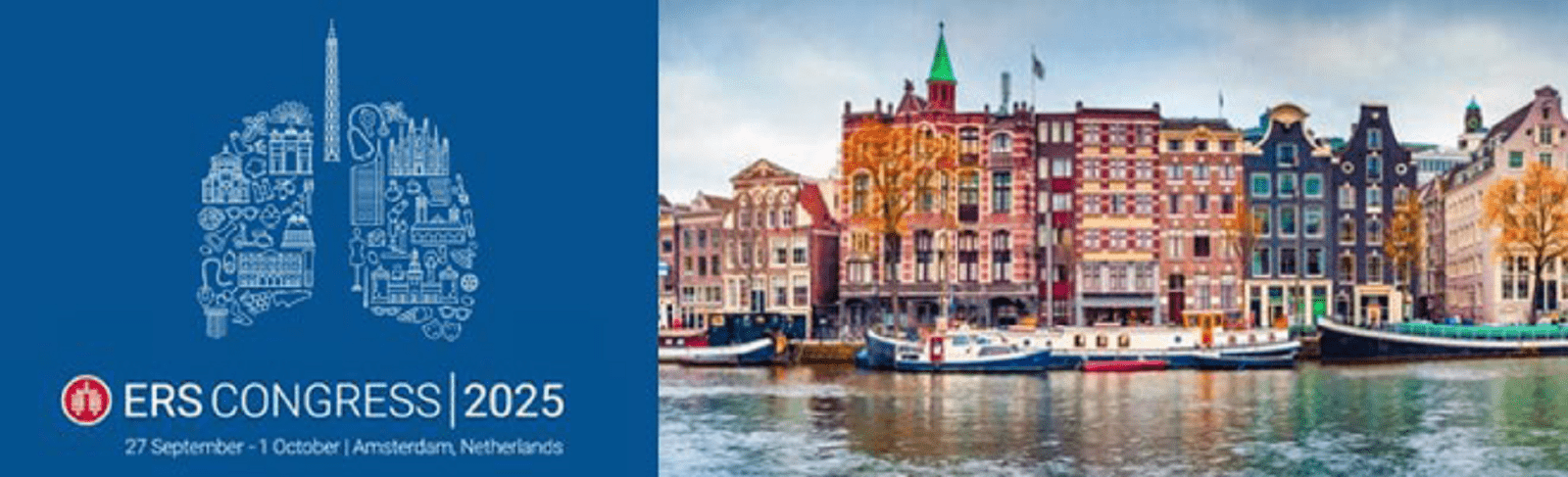 CSL Behring présent au congrès de l’ERS 2025